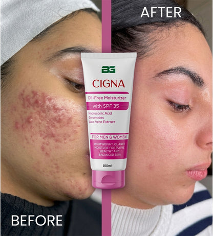 Cigna Oil Free Moisturizer